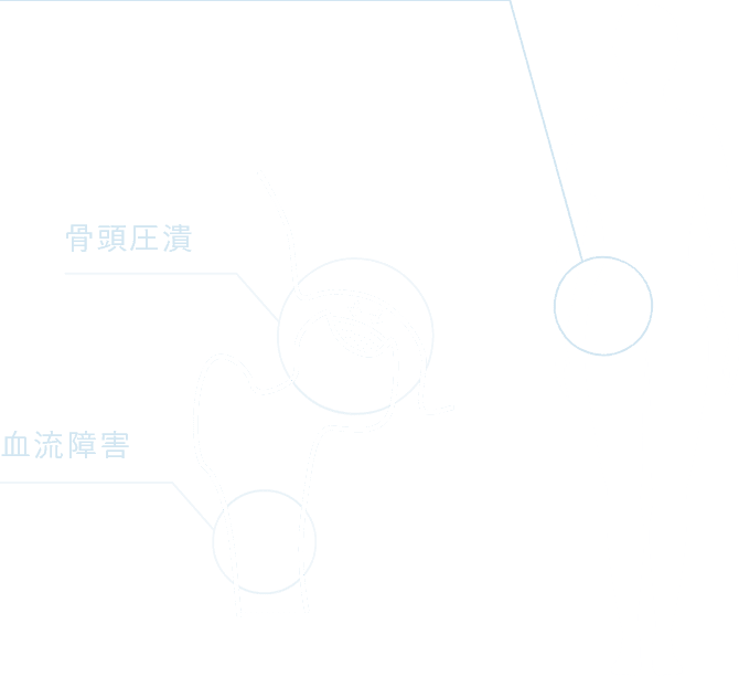 骨頭圧潰 血流障害